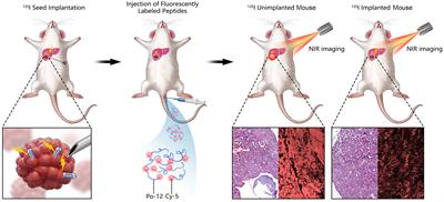 Identification of a novel peptide targeting TIGIT to evaluate immunomodulation of 125I seed brachytherapy in HCC by near-infrared fluorescence